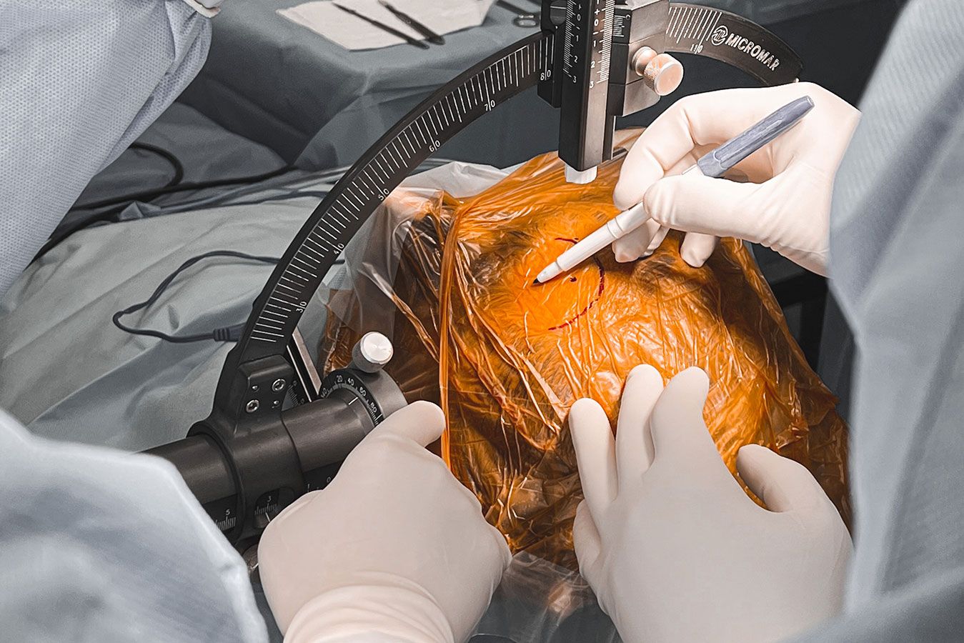 Tumores Cerebrais - Dr. Heros Almeida - Neurocirurgião em São Paulo