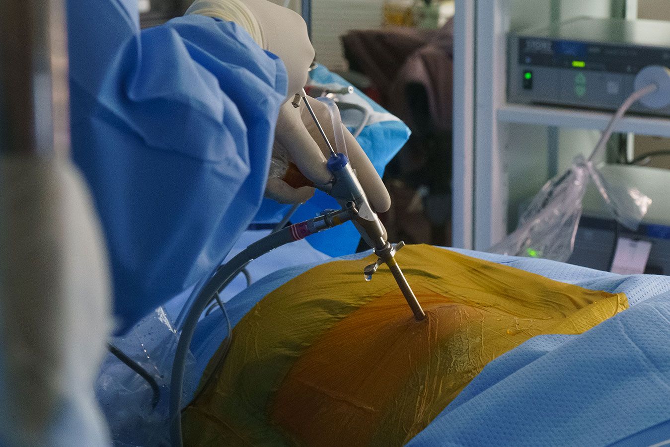 Cirurgia endoscópica da coluna - Dr. Heros Almeida - Neurocirurgião em São Paulo