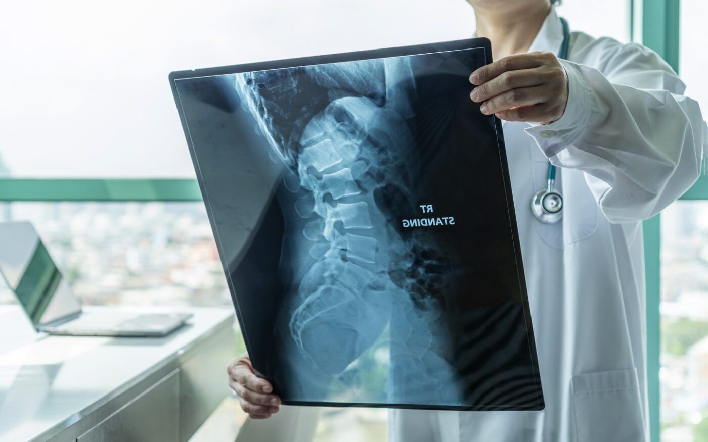 Infiltrações e rizotomias para controle de dor - Dr. Heros Almeida - Neurocirurgião em São Paulo
