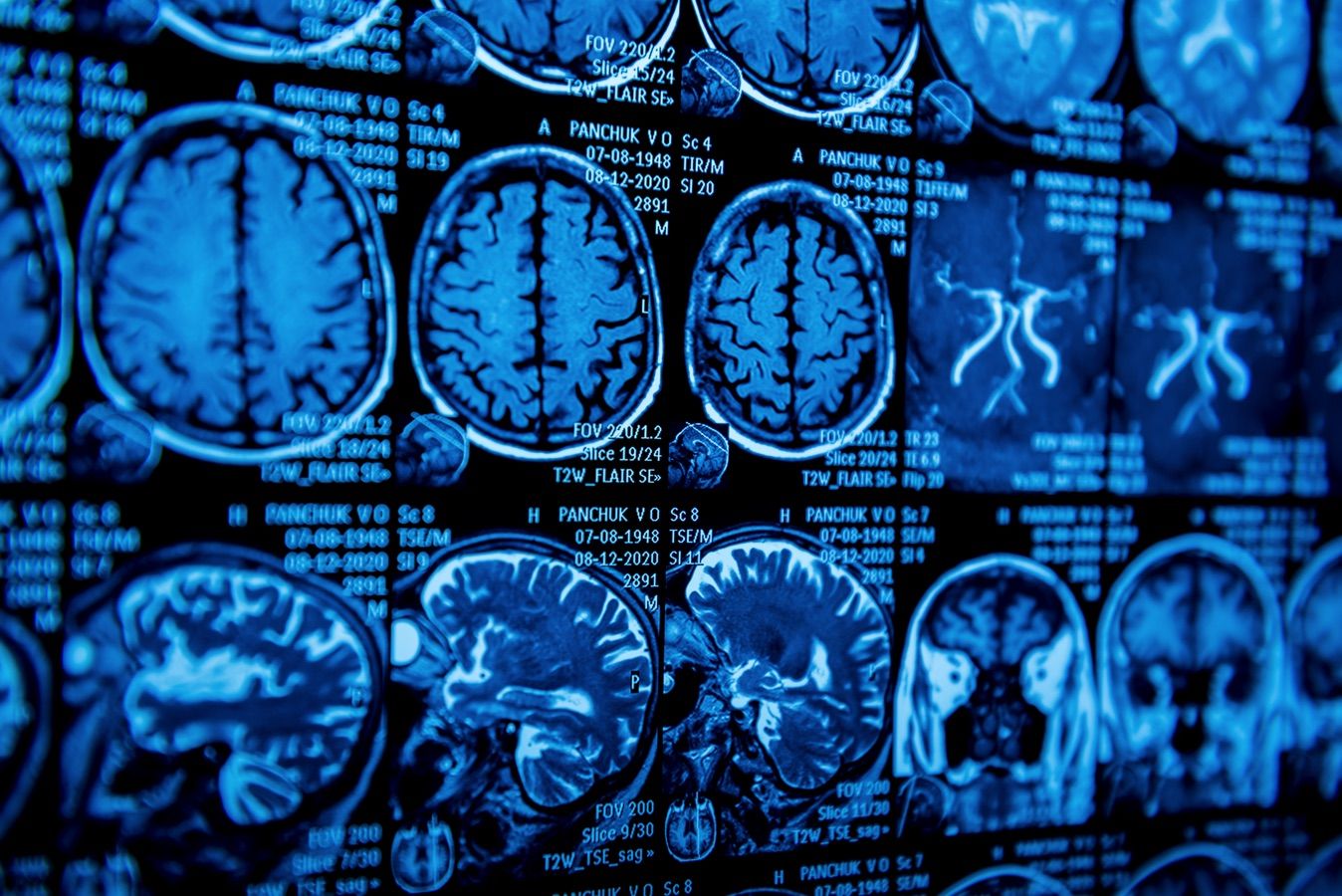 Urgência e Emergência - Dr. Heros Almeida - Neurocirurgião em São Paulo