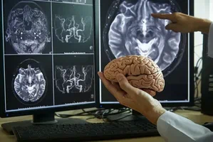 Neurocirurgião